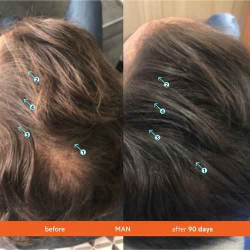 DS Labs Revita Kit 205mL & Scalp Massager – High-Performance Hair Density Shampoo & Conditioner, Volumizing & Thickening, Fuller, Healthier-Looking Hair, Sulfate & Silicone Free, For Men & Women