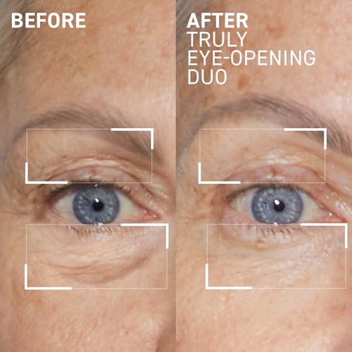 Dr. Brandt Truly Eye Opening Duo - Includes No More Baggage (0.5 oz) & 360¡Æ Firming Eye Cream (0.5 oz)