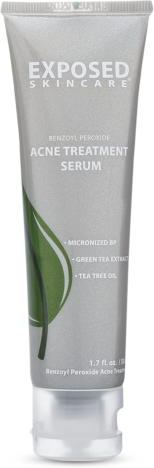 Exposed Skin Care Acne Treatment Serum Step 3 â Quickly Reduces Pimple Size and Redness - 12 Hour Spot Treatment - 3.5% Benzoyl Peroxide, Natural Green Tea & Tea Tree Oil