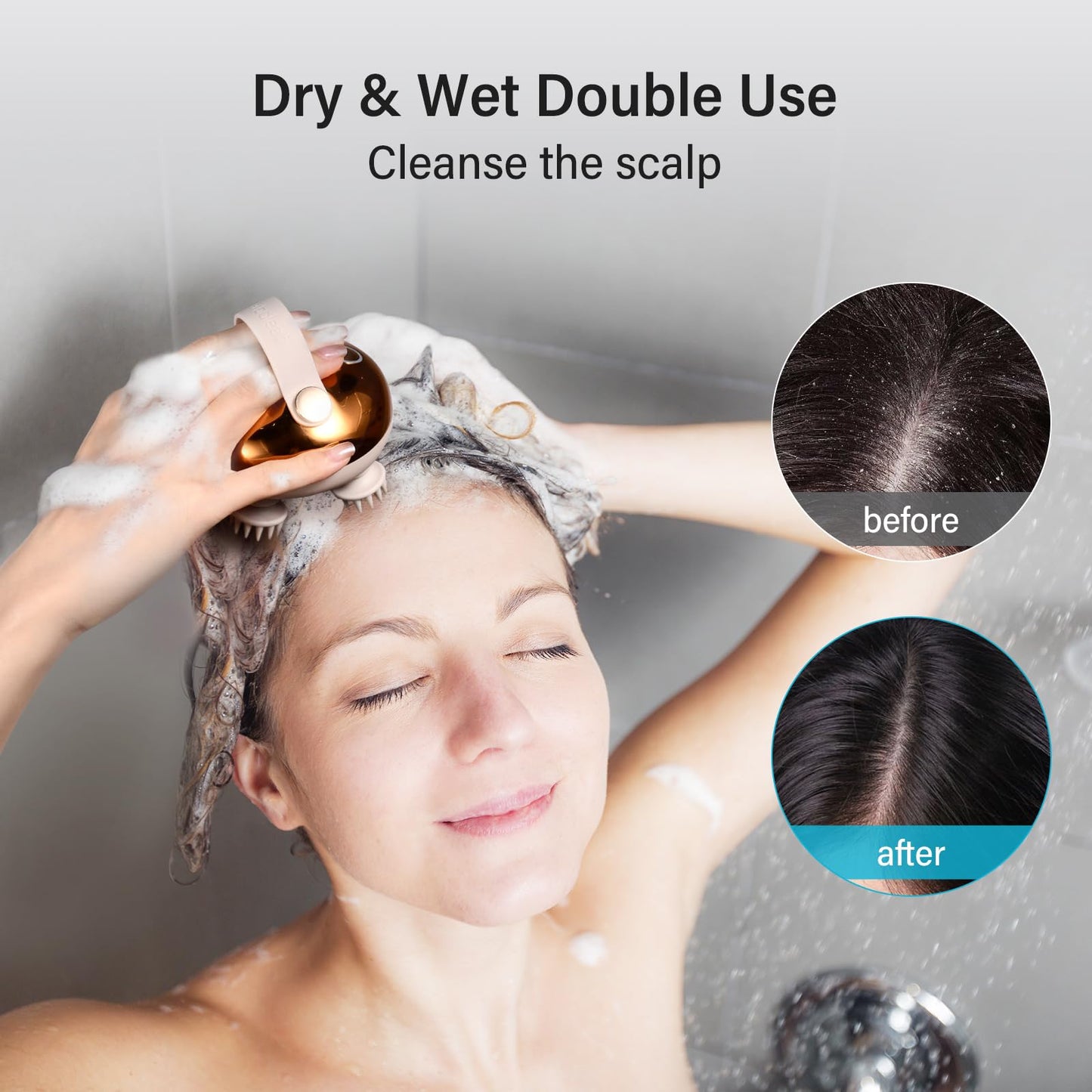 arboleaf Electric Scalp Massager Head Massager Scalp Stress Relax, 5 in 1 Kneading 128 Massage Nodes, Waterproof Hair Massage with 8 Removable Claws Cat Scratcher, Gift for Dad Mom