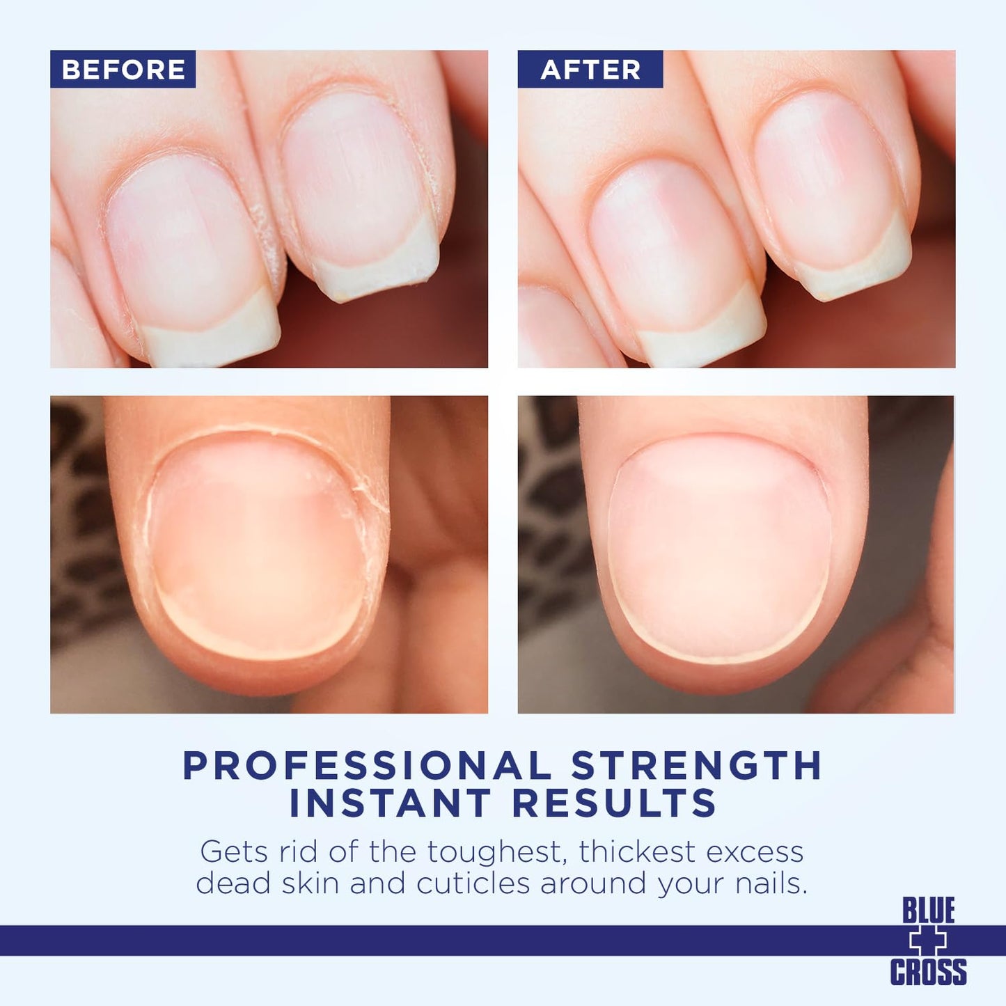 Blue Cross Ultimate Nail Care Bundle - 2oz Cuticle Remover + Softener Cream, 0.5oz Yello Out Yellow Neutralizing Basecoat + 0.5oz Nourishing Cuticle + Nail Oil, 3 Pack Bundle