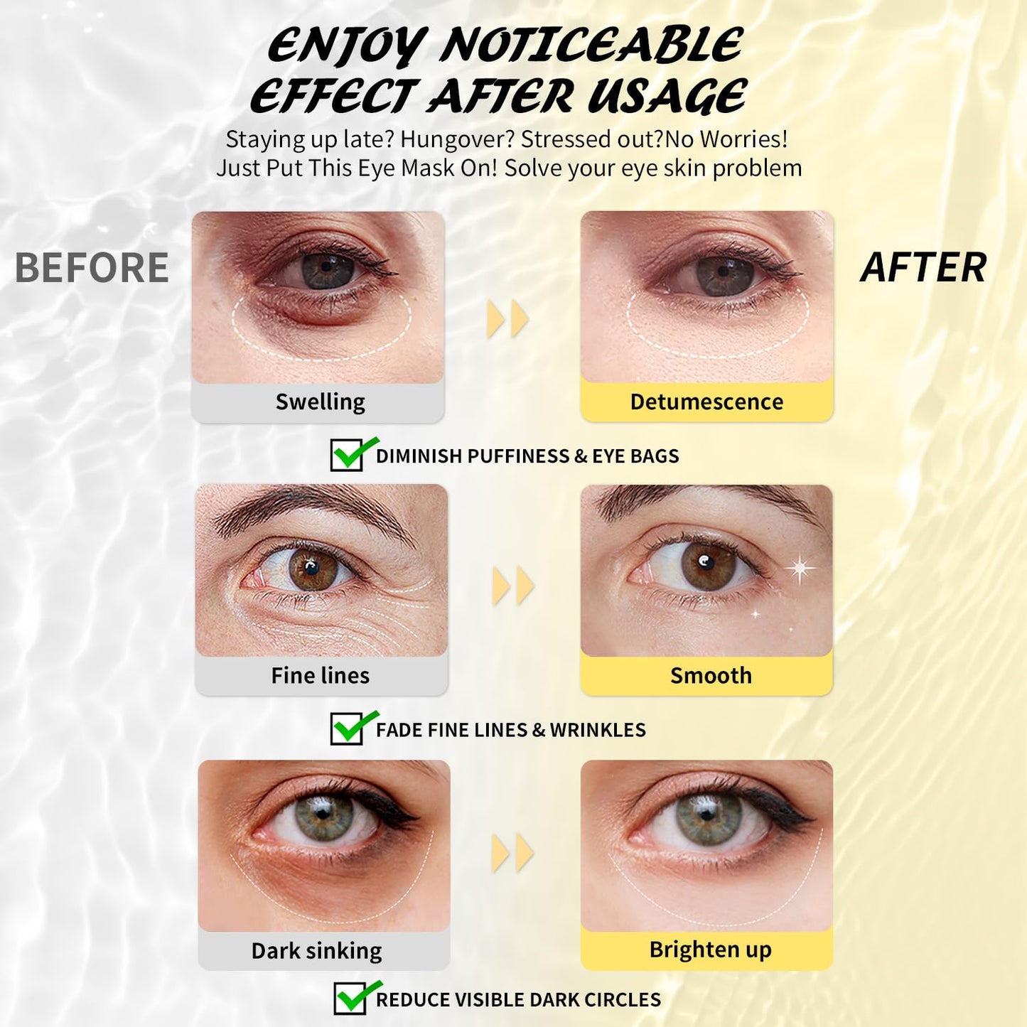 Under Eye Patches (30 Pairs), Caffeine Eye Masks for Dark Circles Puffy Eyes Undereye Bags, Collagen Eye Patches for Wrinkles and Puffiness, Skin Care Gift for Her