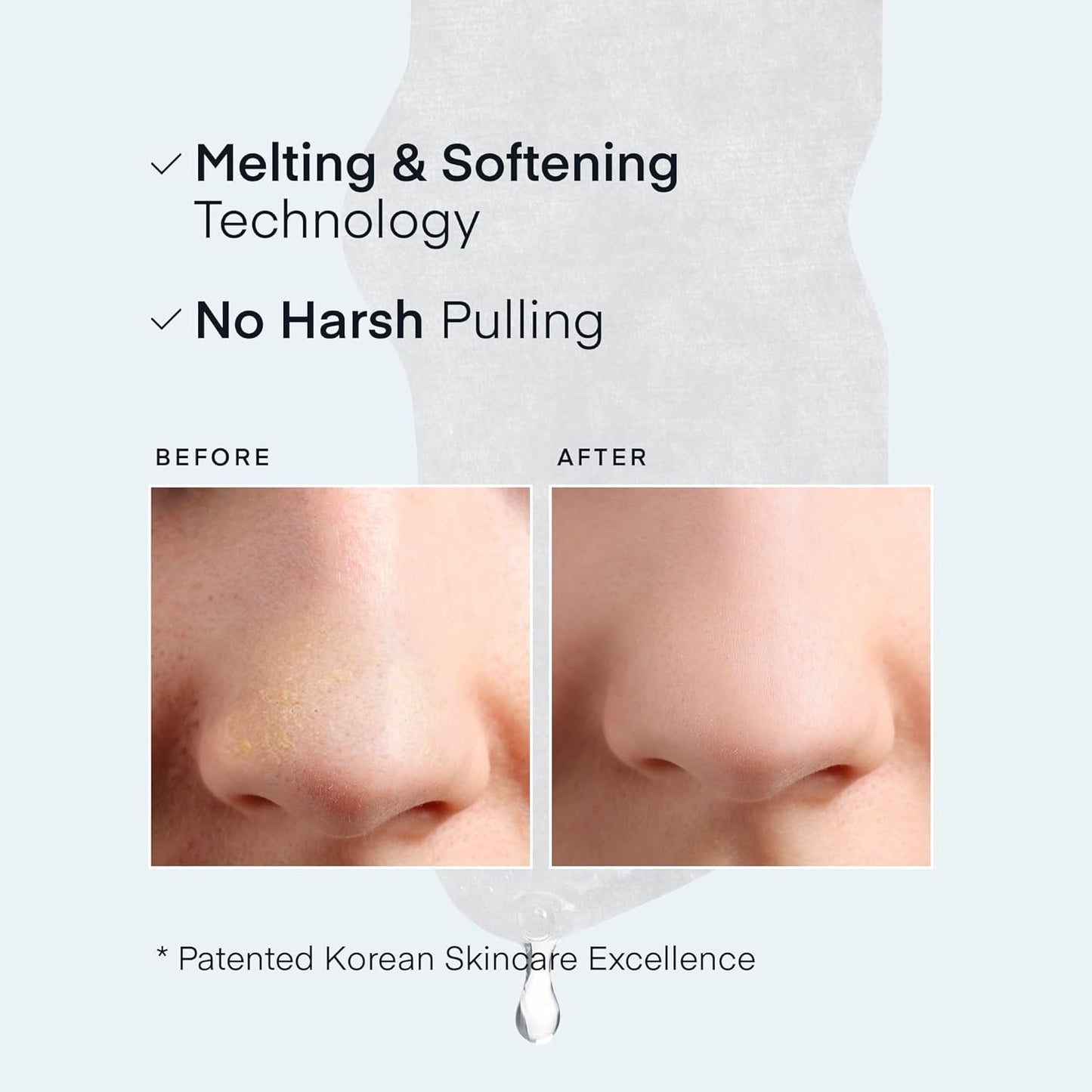 TEREZ & HONOR Korean Melting Pore Strips Blackhead Remover 5 Kits - Sebum Softener, Pore Minimizer Strips - Hypoallergenic Tested, 3-Step Pore Refining Sets