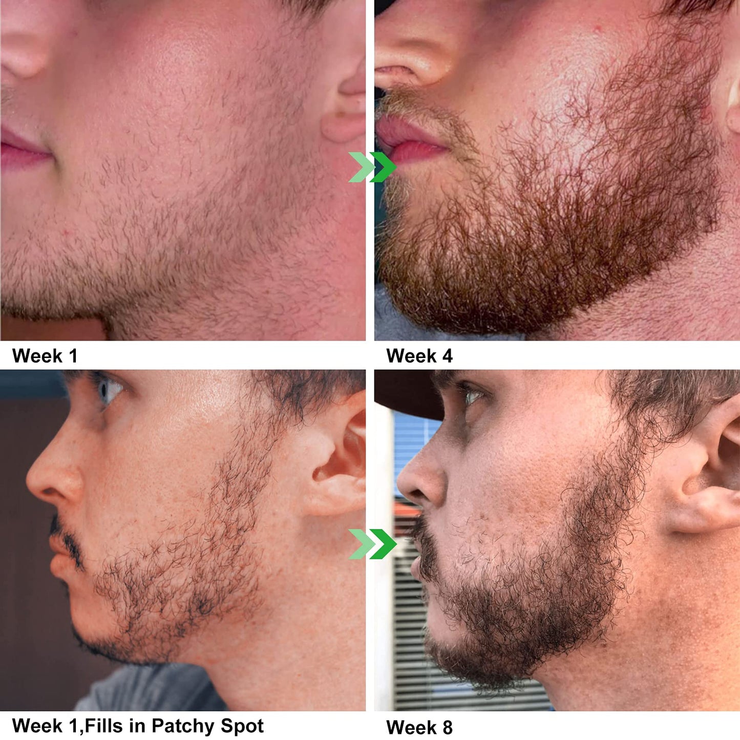 Beard Growth Kit, Beard Kit with Beard Growth Oil, Balm, Comb, Massager for Fuller & Stronger Beards, Birthday Gifts for Men Husband Dad Boyfriend
