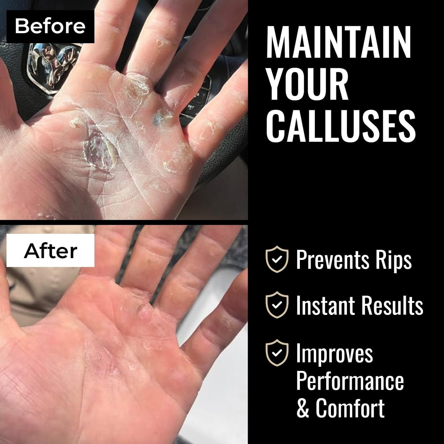 SandBar Callus Remover Tool, File for Hands, Durable Aluminum Tool Callus Shaver, Palm and Heel Dead Skin Removal, Includes Nourishing Salve, Ideal for Athletes, Climbers, and Gym Enthusiasts - Blue