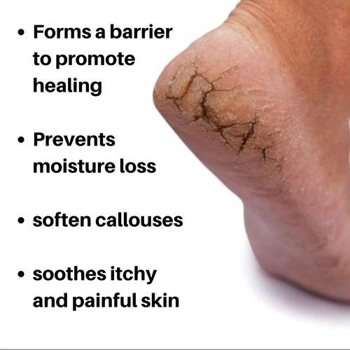 Nordic Care Foot Care Cream 32 oz and 3 oz Foot Care Cream Bundle
