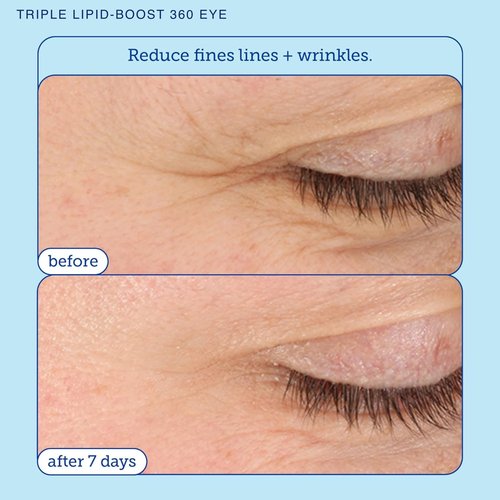 Skinfix Barrier+ Triple Lipid-Peptide Cream (1.7 oz) + Barrier+ Triple Lipid-Boost 360 Eye (0.5 oz) - Non-Comedogenic - Fragrance Free - Vegan, Cruelty Free