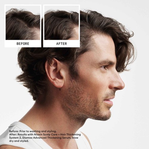 Nioxin System 2 Kit, Cleanse, Condition, and Treat the Scalp for Thicker and Stronger Hair, 3 Month Supply + Sebastian Professional Dark Oil Lightweight Hair Oil, Infused With Jojoba & Argan Oil